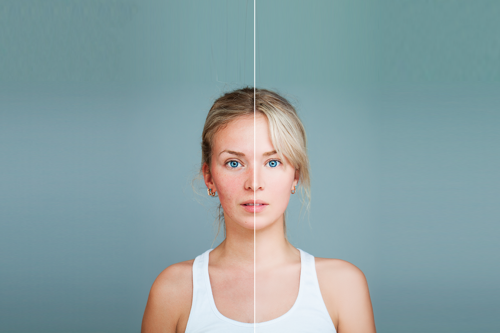 Did you know you can sleep your way to better skin?